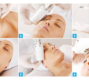 Endosphere Facial Therapy (30min)
