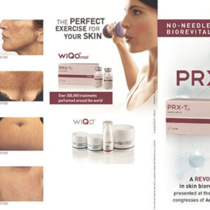 PRX-T33 WiQo Italian Peel