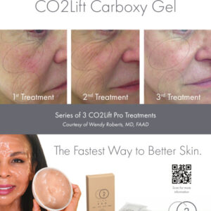 The CO2 Lift Pro Facial