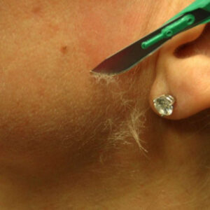 Dermaplaning Single Treatment - Add to any Facial