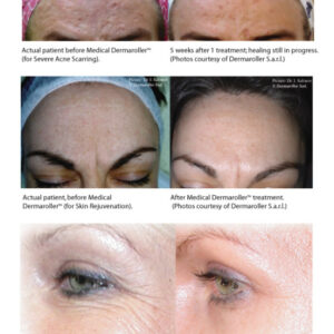 AntiAging CIT Facial