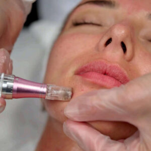 Series of 3 Exosomes Facials