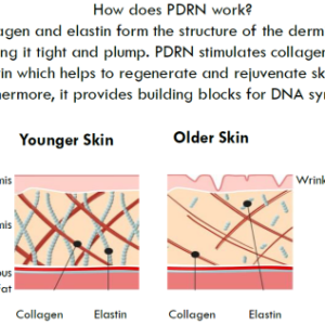 Full Series of 3 Salmon PDRN Facial Treatments